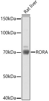 RORA Rabbit pAb