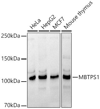 MBTPS1 Rabbit pAb