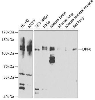 DPP8 Rabbit pAb