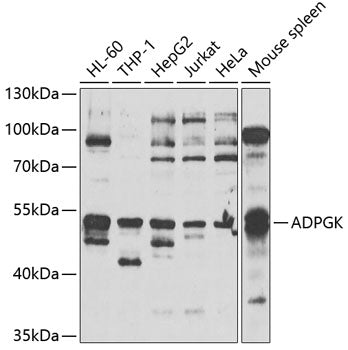 ADPGK Rabbit pAb