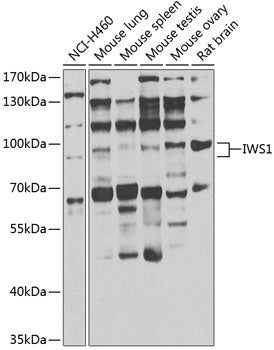 IWS1 Rabbit pAb