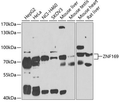 ZNF169 Rabbit pAb