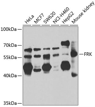 FRK Rabbit pAb
