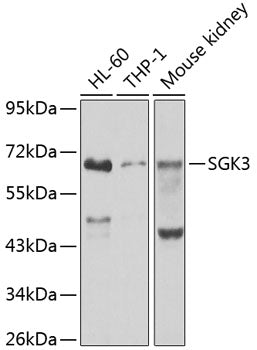 SGK3 Rabbit pAb