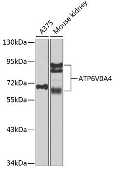 ATP6V0A4 Rabbit pAb