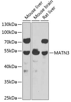 MATN3 Rabbit pAb