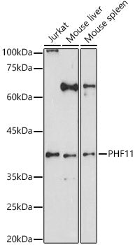 PHF11 Rabbit pAb