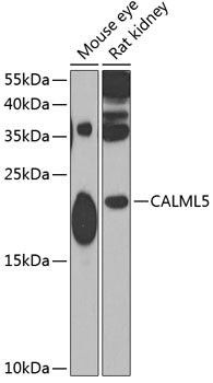 CALML5 Rabbit pAb