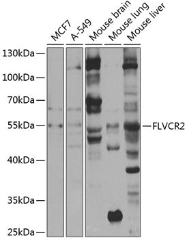 FLVCR2 Rabbit pAb