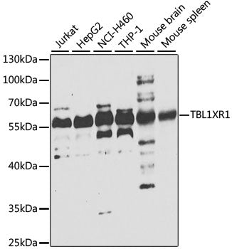 TBL1XR1 Rabbit pAb