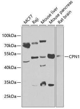 CPN1 Rabbit pAb
