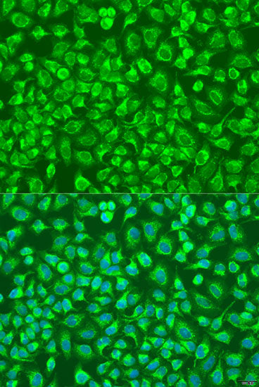 ENTPD5 Rabbit pAb