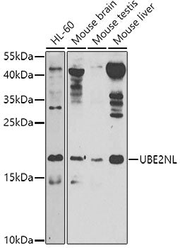 UBE2NL Rabbit pAb
