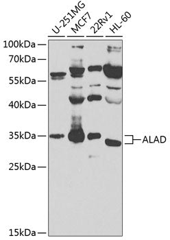 ALAD Rabbit pAb