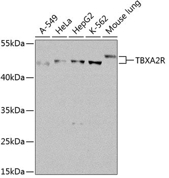 TBXA2R Rabbit pAb