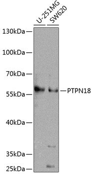 PTPN18 Rabbit pAb