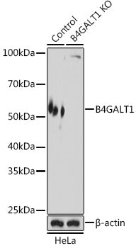 [KO Validated] B4GALT1 Rabbit pAb