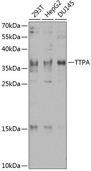 TTPA Rabbit pAb