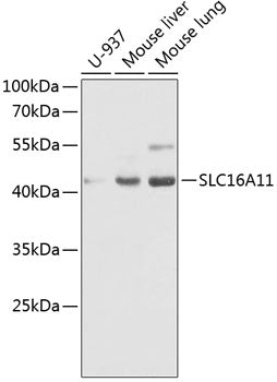 SLC16A11 Rabbit pAb