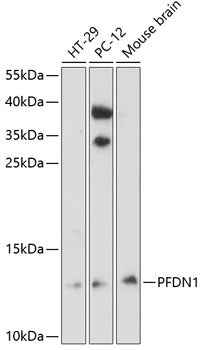 PFDN1 Rabbit pAb