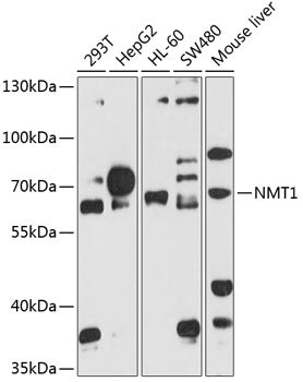 NMT1 Rabbit pAb