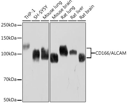 CD166/ALCAM Rabbit mAb