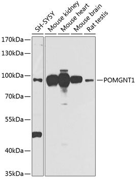 POMGNT1 Rabbit pAb