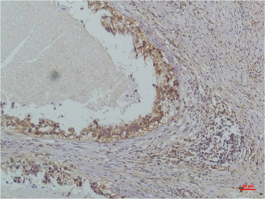 IKB beta (5H3) Mouse Monoclonal Antibody