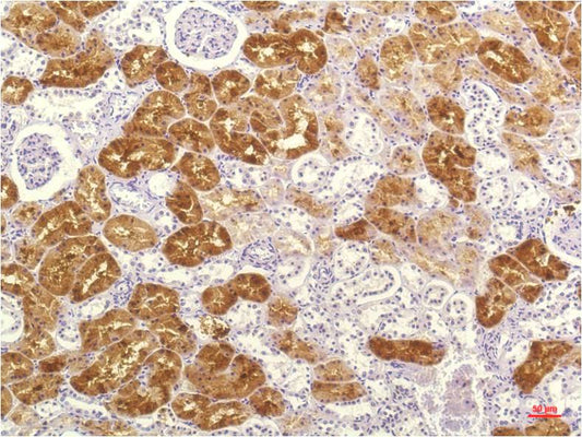 IL-8 (3A4) Mouse Monoclonal Antibody