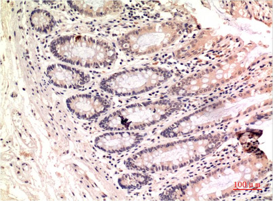gamma Tubulin (8H4) Mouse Monoclonal Antibody
