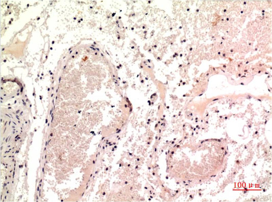 gamma Tubulin (9B5) Mouse Monoclonal Antibody