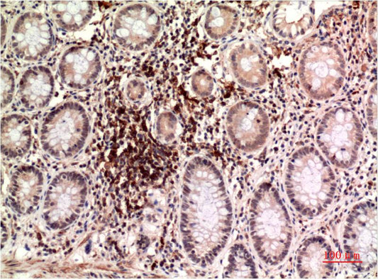 epsilon Tubulin (4C4) Mouse Monoclonal Antibody