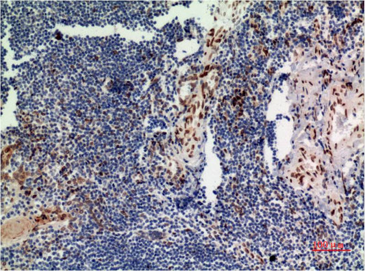 ERK1 (1D10) Mouse Monoclonal Antibody