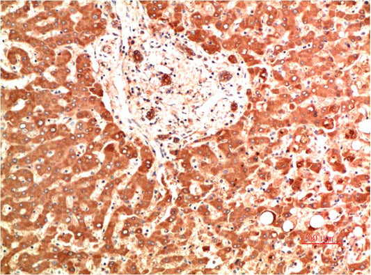 Collagen IV alpha 1 (2G3) Mouse Monoclonal Antibody