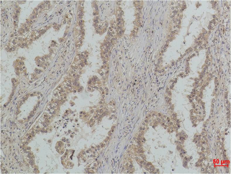 MonoMethyl-p53 (Lys370) (4C7) Mouse Monoclonal Antibody