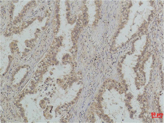 MonoMethyl-p53 (Lys370) (4C7) Mouse Monoclonal Antibody