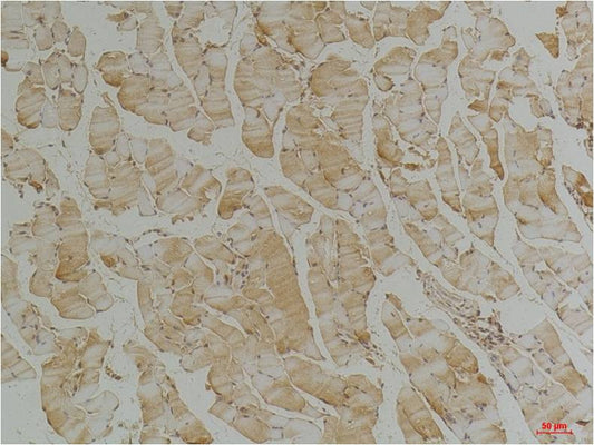 Desmin (4H1) Mouse Monoclonal Antibody