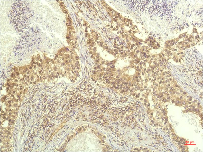 S6K1 (3A2) Mouse Monoclonal Antibody