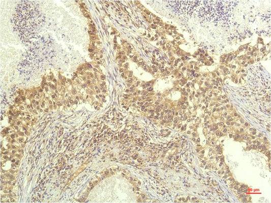 S6K1 (3A2) Mouse Monoclonal Antibody