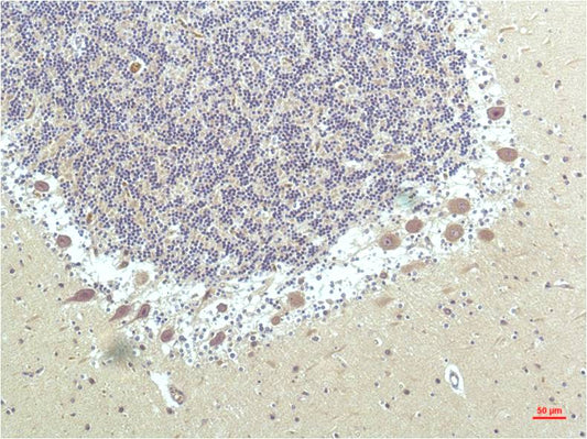 PPAR delta (4F4) Mouse Monoclonal Antibody