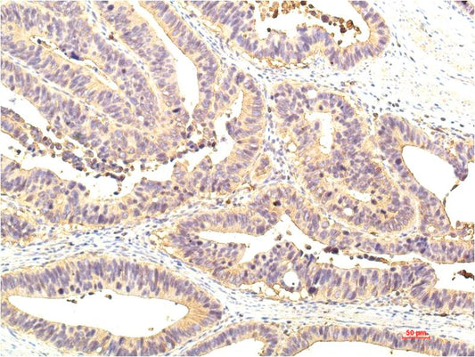 STAT1 (10F1) Mouse Monoclonal Antibody