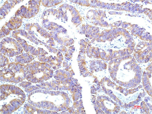 STAT1 (9G8) Mouse Monoclonal Antibody