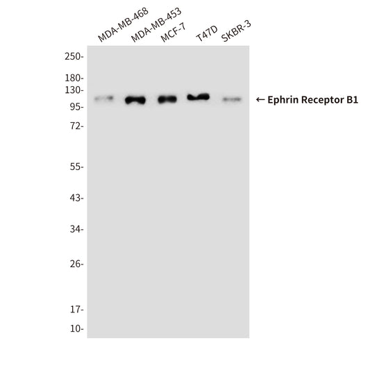 Ephrin Receptor B1 (9B4) Mouse Monoclonal Antibody