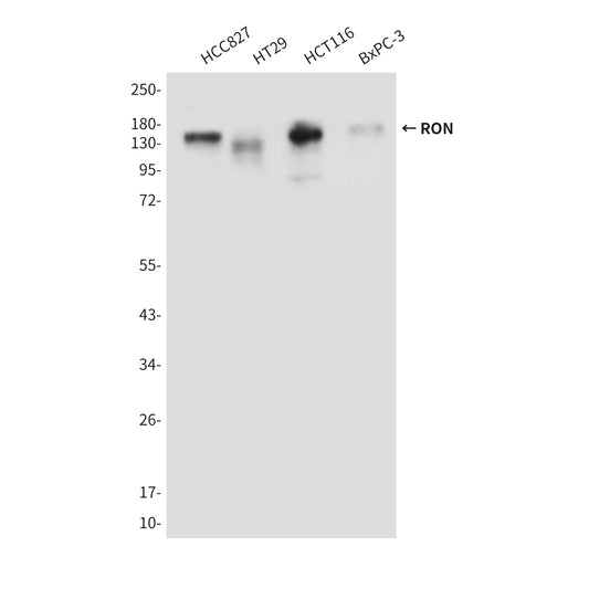 RON (9B6) Mouse Monoclonal Antibody