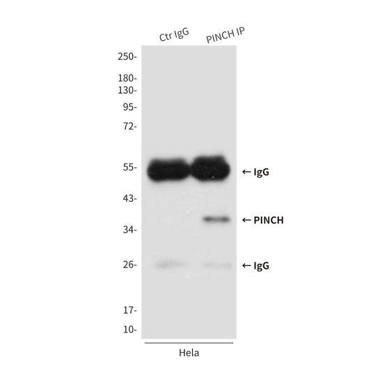 PINCH (3C12) Mouse Monoclonal Antibody