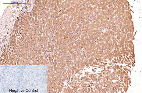 Cytokeratin 17 (8C6) Mouse Monoclonal Antibody