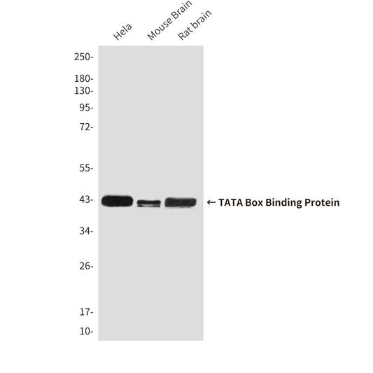 TATA Box Binding Protein (9D1) Mouse Monoclonal Antibody
