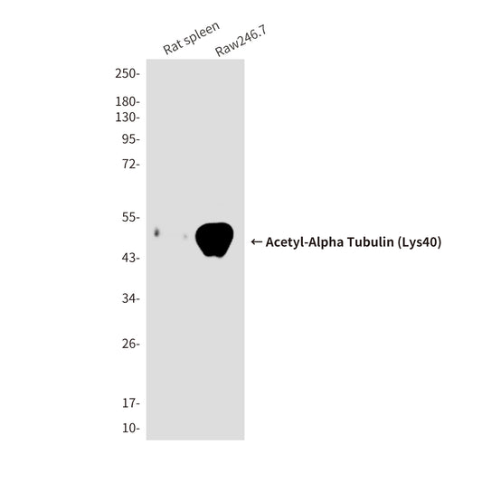Acetyl-Alpha Tubulin (Lys40) (6B5) Mouse Monoclonal Antibody