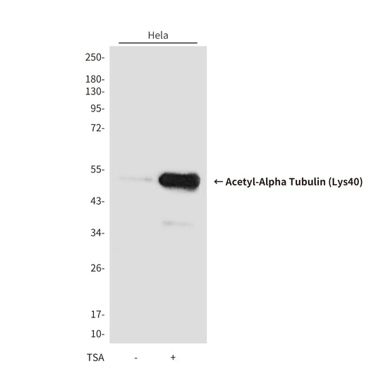 Acetyl-Alpha Tubulin (Lys40) (9B8) Mouse Monoclonal Antibody