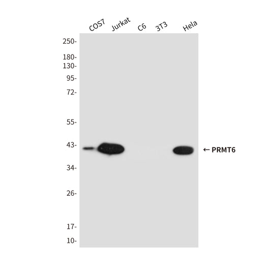 PRMT6 Mouse Monoclonal Antibody